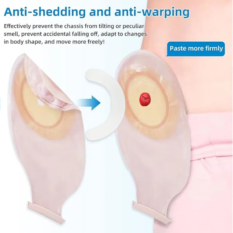 Medical Tape - Medyczna taśma wzmacniająca do worków stomijnych,